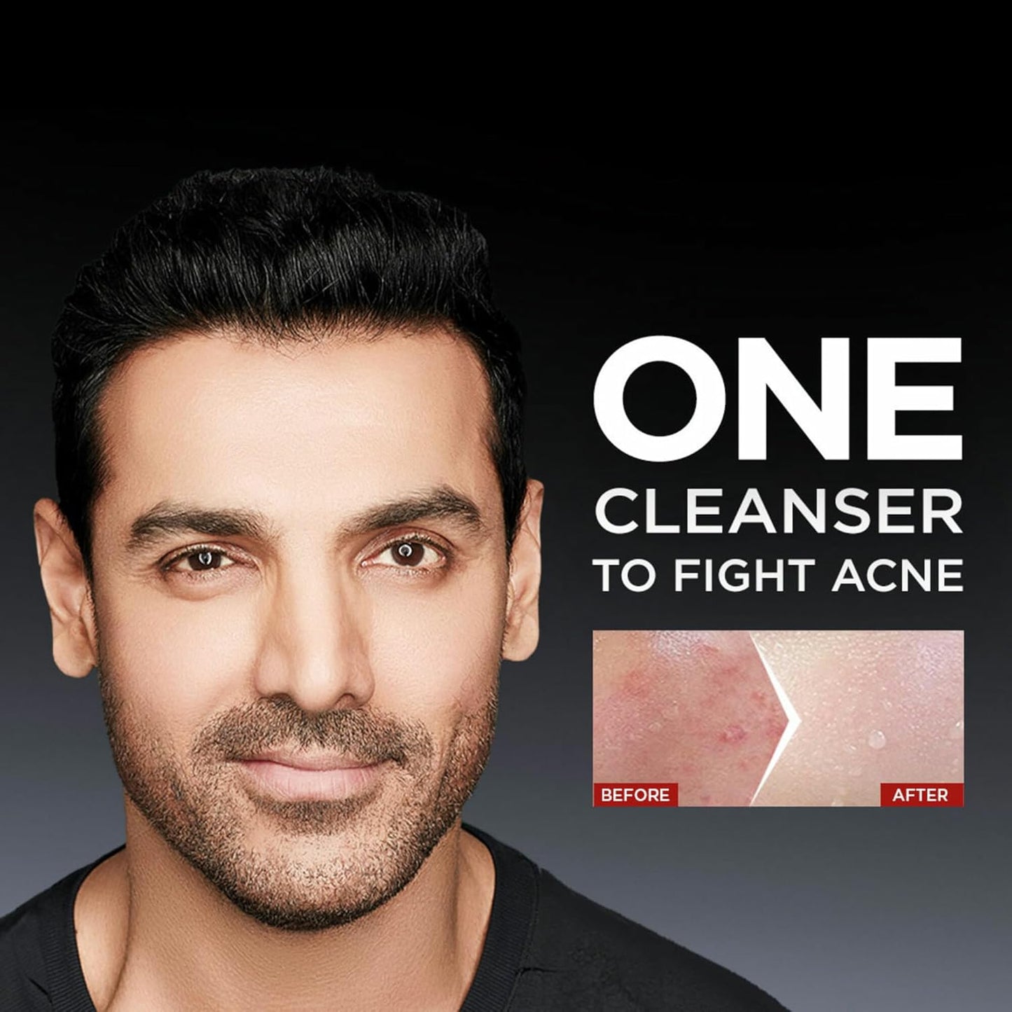 Garnier Men Acno Fight Anti Pimple Face Wash, Anti Pimple Face Wash with Salicylic Acid and Herba Repair, Suitable for all Skin Types, 150g